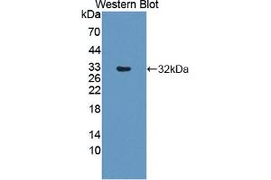 Figure. (DPYD anticorps  (AA 169-422))
