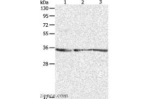 Western blot analysis of NIH/3T3, A431 and Jurkat cell, using RPLP0 Polyclonal Antibody at dilution of 1:750 (RPLP0 anticorps)