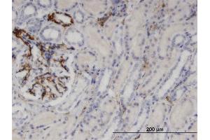 Immunoperoxidase of monoclonal antibody to UPP1 on formalin-fixed paraffin-embedded human kidney.