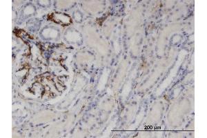 Immunoperoxidase of monoclonal antibody to UPP1 on formalin-fixed paraffin-embedded human kidney.