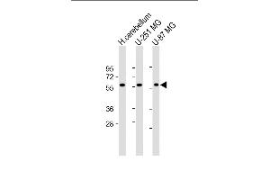 All lanes : Anti-SHC2 Antibody (N-Term) at 1:2000 dilution Lane 1: Human cerebellum lysate Lane 2: U-251 MG whole cell lysate Lane 3: U-87 MG whole cell lysate Lysates/proteins at 20 μg per lane.