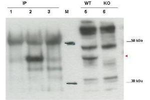 Image no. 1 for anti-Cytohesin 1 Interacting Protein (CYTIP) (C-Term) antibody (ABIN1101060) (CYTIP anticorps  (C-Term))