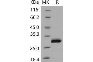 Western Blotting (WB) image for Ubiquitin Carboxyl-terminal Esterase L3 (Ubiquitin Thiolesterase) (Uchl3) (Active) protein (His tag) (ABIN7320189) (UCHL3 Protein (His tag))