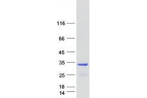 Osteoclast Stimulating Factor 1 (OSTF1) protein (Myc-DYKDDDDK Tag)