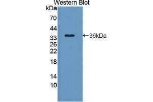 Detection of Recombinant TAK1L, Human using Polyclonal Antibody to TAK1 Like Protein (TAK1L) (MAP3K7CL anticorps  (AA 1-242))