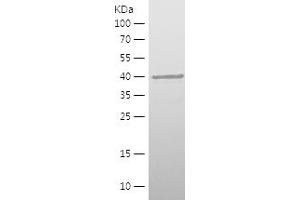 Western Blotting (WB) image for Microtubule-Associated Protein 1B (MAP1B) (AA 2094-2358) protein (His tag) (ABIN7123962)