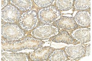 ABIN6261678 and ABIN6268891 at 1/100 staining Rat testis tissue by IHC-P.