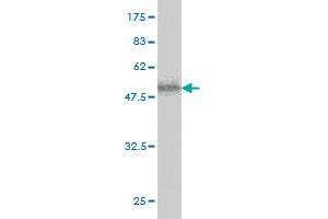 Western Blot detection against Immunogen (58. (ICK anticorps  (AA 1-292))