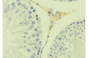 ABIN6279287 at 1/100 staining Mouse testis tissue by IHC-P. (CKLF anticorps  (C-Term))