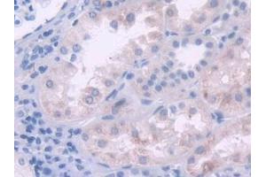 Detection of IL2 in Human Kidney Tissue using Polyclonal Antibody to Interleukin 2 (IL2) (IL-2 anticorps  (AA 21-153))