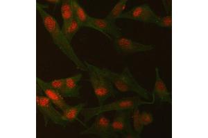 IF analysis of SMCHD1 and Tubulin beta using anti-SMCHD1 antibody (ABIN7602032) and anti-Tubulin beta antibody (ABIN7602744).