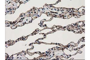 Image no. 3 for anti-Annexin A3 (ANXA3) antibody (ABIN1496642)