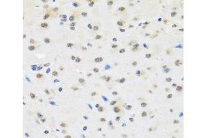 Immunohistochemistry of paraffin-embedded Mouse brain using SAFB2 Polyclonal Antibody at dilution of 1:100 (40x lens). (SAFB2 anticorps)