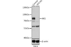Western blot analysis of extracts from normal (control) and NF2 knockout (KO) HeLa cells, using NF2 antibody (ABIN6128275, ABIN6144548, ABIN6144551 and ABIN7101344) at 1:1000 dilution.