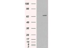 Western Blotting (WB) image for anti-Myotubularin 1 (MTM1) (C-Term) antibody (ABIN2465965) (MTM1 anticorps  (C-Term))