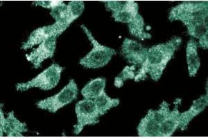 Immunofluoresent staining of ES2 cells with anti-CD105/endoglin antibody. (Endoglin anticorps  (AA 24-144))