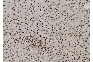 ABIN6272965 at 1/100 staining Mouse liver tissue by IHC-P. (MTA3 anticorps  (Internal Region))