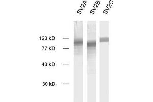 SV2B 抗体  (AA 2-17)