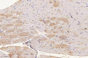 Immunohistochemistry analysis of paraffin-embedded mouse muscle using,SLC8A3 (ABIN7075684) at dilution of 1: 1600 (SLC8A3 anticorps)