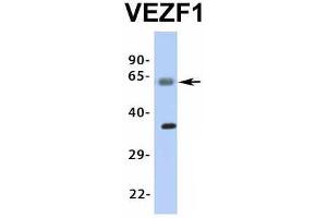 Host:  Rabbit  Target Name:  VEZF1  Sample Type:  Human Fetal Muscle  Antibody Dilution:  1.
