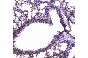 IHC analysis of MYLK using anti-MYLK antibody . (MYLK anticorps  (AA 1441-1709))