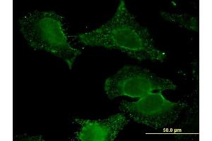 Immunofluorescence of monoclonal antibody to ALDH9A1 on HeLa cell. (ALDH9A1 anticorps  (AA 173-270))