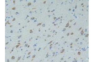 IHC-P analysis of Human Brain Tissue, with DAB staining. (SMAD9 anticorps  (AA 226-459))
