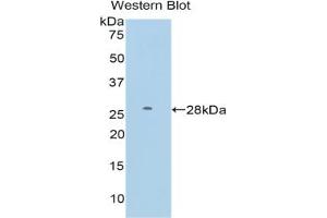 Western blot analysis of the recombinant protein. (FDFT1 anticorps  (AA 187-416))
