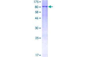 Image no. 1 for Matrix Metallopeptidase 19 (MMP19) (AA 1-508) protein (GST tag) (ABIN1311069)