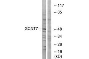 Western blot analysis of extracts from K562 cells, using GCNT7 Antibody.