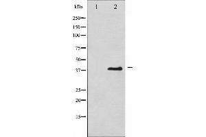 Western blot analysis of eIF2 alpha phosphorylation expression in IFN-α treated K562 whole cell lysates,The lane on the left is treated with the antigen-specific peptide.