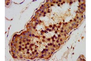 IHC image of ABIN7144009 diluted at 1:200 and staining in paraffin-embedded human testis tissue performed on a Leica BondTM system. (AMMECR1 anticorps  (AA 146-248))