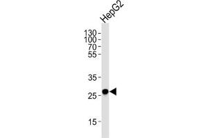 Western Blotting (WB) image for anti-Enoyl-CoA Delta Isomerase 1 (ECI1) antibody (ABIN3003901)