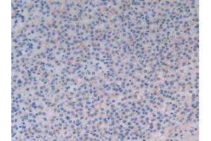 Detection of MFGE8 in Rat Adrenal Gland Tissue using Polyclonal Antibody to Milk Fat Globule EGF Factor 8 (MFGE8)