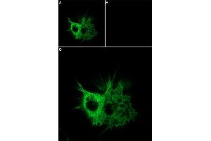 Unlabeled ω-Agatoxin successfully blocks CaV2.