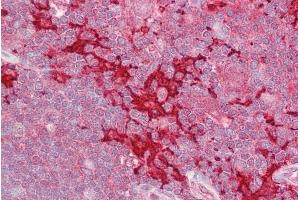 anti-Mitogen-Activated Protein Kinase Kinase Kinase Kinase 1 (MAP4K1) (N-Term) antibody