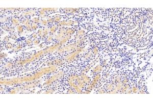 Detection of ROR1 in Mouse Kidney Tissue using Polyclonal Antibody to Receptor Tyrosine Kinase Like Orphan Receptor 1 (ROR1)