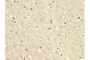 IHC image of ABIN7166949 diluted at 1:200 and staining in paraffin-embedded human brain tissue performed on a Leica BondTM system. (GDI1 anticorps  (AA 35-170))
