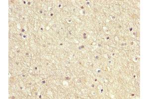 IHC image of ABIN7166949 diluted at 1:200 and staining in paraffin-embedded human brain tissue performed on a Leica BondTM system. (GDI1 anticorps  (AA 35-170))