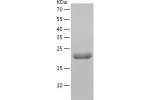 Western Blotting (WB) image for Molybdenum Cofactor Synthesis 2 (MOCS2) (AA 1-188) protein (His-IF2DI Tag) (ABIN7124015)