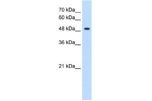 WB Suggested Anti-GLYCTK Antibody Titration:  1. (GLYCTK anticorps  (N-Term))