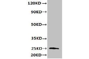 Western blot All lanes: TMED3 antibody at 6 μg/mL + MCF-7 whole cell lysate Secondary Goat polyclonal to rabbit IgG at 1/10000 dilution Predicted band size: 25, 20 kDa Observed band size: 25 kDa