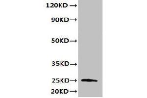 Western blot All lanes: TMED3 antibody at 6 μg/mL + MCF-7 whole cell lysate Secondary Goat polyclonal to rabbit IgG at 1/10000 dilution Predicted band size: 25, 20 kDa Observed band size: 25 kDa (TMED3 anticorps  (AA 24-180))