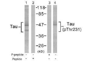 Image no. 2 for anti-Microtubule-Associated Protein tau (MAPT) (Thr231) antibody (ABIN197266) (MAPT anticorps  (Thr231))