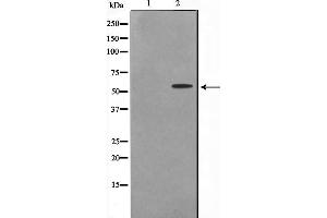 Western blot analysis on K562 cell lysate using DAK Antibody，The lane on the left is treated with the antigen-specific peptide. (DAK anticorps  (Internal Region))