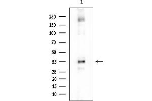 anti-Pyrophosphatase (Inorganic) 1 (PPA1) (Internal Region) antibody