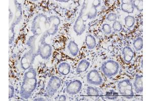 Immunoperoxidase of monoclonal antibody to LRIT3 on formalin-fixed paraffin-embedded human small Intestine.