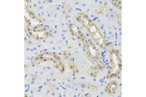Immunohistochemistry of paraffin-embedded rat kidney using DISC1 antibody (ABIN5971500) at dilution of 1/100 (40x lens). (DISC1 anticorps)