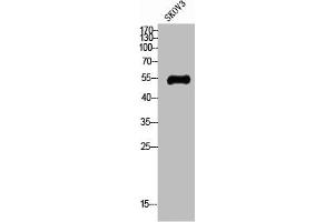 Western Blot analysis of SKOV3 cells using Glut4 Polyclonal Antibody