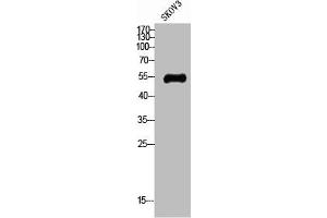 Western Blot analysis of SKOV3 cells using Glut4 Polyclonal Antibody (GLUT4 anticorps  (N-Term))